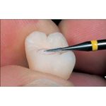 Fresón de Carburo Tungsteno